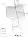 Fig. 10 - Interactive anterior-posterior axis determination