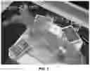 Fig. 03 - System and method for holographic image-guided percutaneous endovascular percutaneous procedures