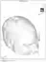 Fig. 08 - Method, system and apparatus for surface rendering using medical imaging data