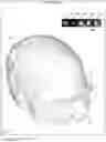 Fig. 09 - Method, system and apparatus for surface rendering using medical imaging data