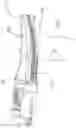 Fig. 14 - SURGICAL INSTRUMENT, ROBOTIC ARM AND CONTROL SYSTEM FOR A ROBOTIC ARM