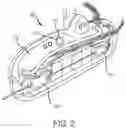 Fig. 03 - System and method of automatic detection of obstructions for a robotic catheter system