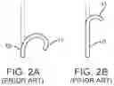 Fig. 03 - Steerable catheter with shaft load distributions