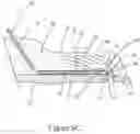 Fig. 07 - Apparatus and method for treating rhinitis