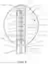 Fig. 12 - Apparatus and method for treating rhinitis