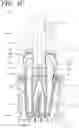 Fig. 10 - Apparatus, methods, and compositions for endodontic treatments