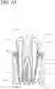 Fig. 12 - Apparatus, methods, and compositions for endodontic treatments