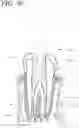 Fig. 14 - Apparatus, methods, and compositions for endodontic treatments