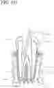 Fig. 15 - Apparatus, methods, and compositions for endodontic treatments
