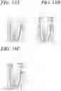 Fig. 26 - Apparatus, methods, and compositions for endodontic treatments