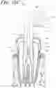 Fig. 29 - Apparatus, methods, and compositions for endodontic treatments