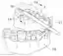 Fig. 01 - Mouth piece removal tool