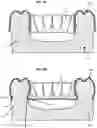 Fig. 06 - Retainer Engaging the Gums and a Method for Creating Such