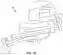 Fig. 03 - Orthodontic device