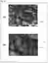 Fig. 13 - Biological tissue rootage face, implant, method for forming biological tissue rootage face, and method for producing implant