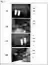 Fig. 19 - Biological tissue rootage face, implant, method for forming biological tissue rootage face, and method for producing implant