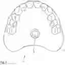 Fig. 02 - Prosthesis as well as retrofit kit for a prosthesis