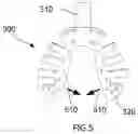 Fig. 05 - Method for making a set of dentures