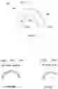 Fig. 21 - Method for making a set of dentures