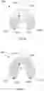 Fig. 22 - Method for making a set of dentures