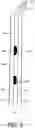 Fig. 06 - ORAL CLEANING DEVICE WITH IMPROVED NOZZLE DESIGN