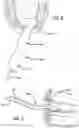 Fig. 05 - SALIVA EJECTOR APPLIANCE