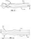 Fig. 06 - SALIVA EJECTOR APPLIANCE