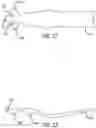 Fig. 07 - SALIVA EJECTOR APPLIANCE