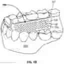 Fig. 03 - Breath Elude