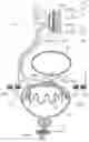 Fig. 01 - Implantable device for internal urinary control