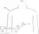 Fig. 05 - Implantable device for internal urinary control