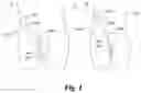 Fig. 02 - SYSTEMS AND METHODS FOR ASSISTING PATIENTS IN EMPTYING THEIR BLADDER EFFICIENTLY