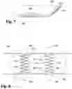Fig. 06 - SYSTEMS AND METHODS FOR ASSISTING PATIENTS IN EMPTYING THEIR BLADDER EFFICIENTLY