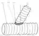 Fig. 01 - Artificial vascular graft and method for making same