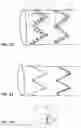 Fig. 09 - Artificial vascular graft and method for making same