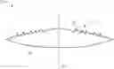 Fig. 01 - DIFFRACTIVE MULTIFOCAL IMPLANTABLE LENS DEVICE