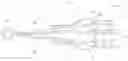 Fig. 01 - Vascular implant and delivery system
