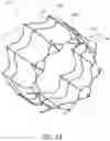 Fig. 06 - Vascular implant and delivery system