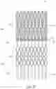 Fig. 09 - Vascular implant and delivery system