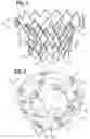 Fig. 02 - Percutaneous mitral valve replacement device