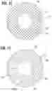 Fig. 09 - Percutaneous mitral valve replacement device
