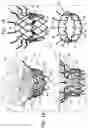 Fig. 02 - Prosthetic valve with atrial arms