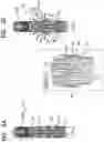 Fig. 03 - Prosthetic valve with atrial arms