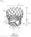 Fig. 02 - Transcatheter valve prosthesis and a concurrently delivered sealing component
