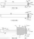 Fig. 05 - Transcatheter valve prosthesis and a concurrently delivered sealing component