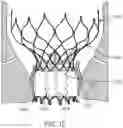 Fig. 08 - Transcatheter valve prosthesis and a concurrently delivered sealing component