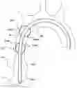 Fig. 01 - Delivery system having an integral centering mechanism for positioning a valve prosthesis in situ