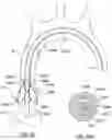 Fig. 22 - Delivery system having an integral centering mechanism for positioning a valve prosthesis in situ