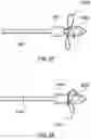 Fig. 24 - Delivery system having an integral centering mechanism for positioning a valve prosthesis in situ