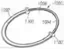 Fig. 01 - Method for converting an annuloplasty ring in vivo